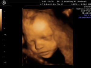 Hey Baby! 4D Ultrasound Studio