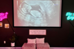 Considering 3D or 4D Ultrasound?   Frequently Asked Questions